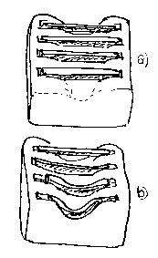 Holdcroft's bars illustration